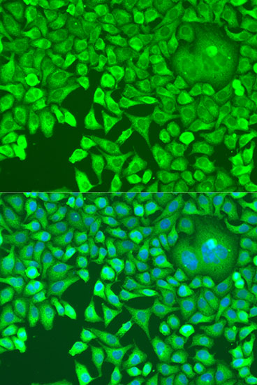 pum1 Polyclonal Antibody (E-AB-64604)