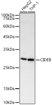 CIDEB Polyclonal Antibody (E-AB-91710)