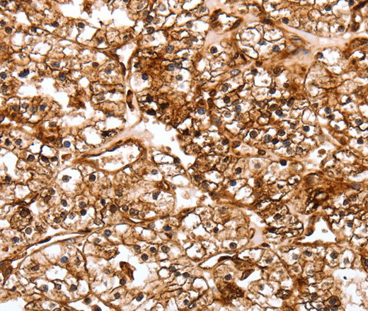 SLC9A3R2 Polyclonal Antibody (E-AB-15845)