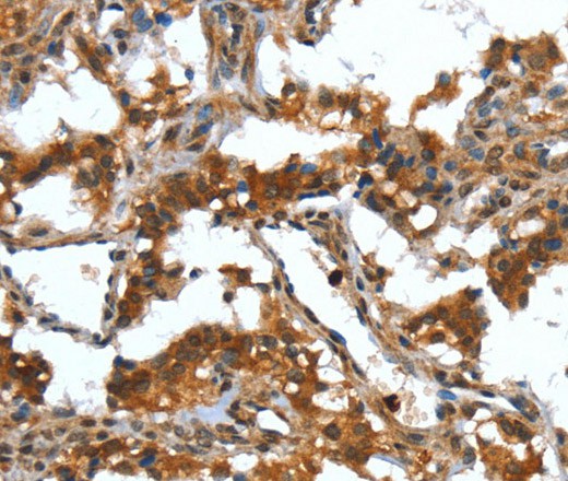 DEFA4 Polyclonal Antibody (E-AB-16384)