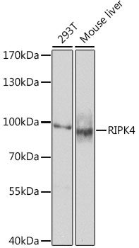 RIPK4 Polyclonal Antibody (E-AB-62455)