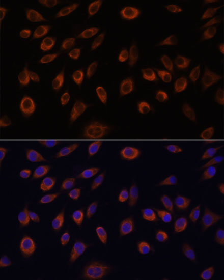 NTPCR Polyclonal Antibody (E-AB-65156)