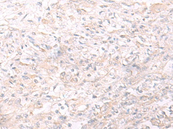 IL26 Polyclonal Antibody (E-AB-19815)