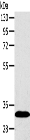 SULT2A1 Polyclonal Antibody (E-AB-11615)