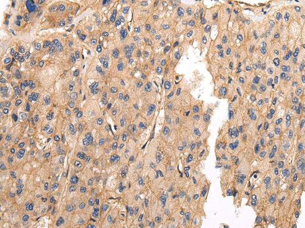 VAMP5 Polyclonal Antibody (E-AB-17244)