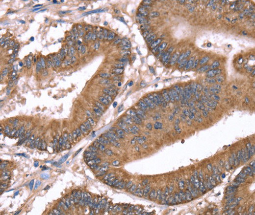HRG Polyclonal Antibody (E-AB-16488)