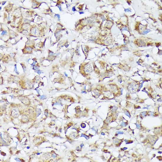 MTHFD2 Polyclonal Antibody (E-AB-65766)