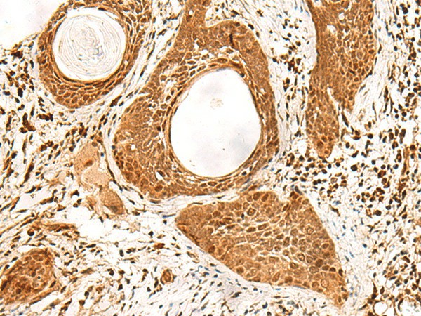 ADRM1 Polyclonal Antibody (E-AB-18828)