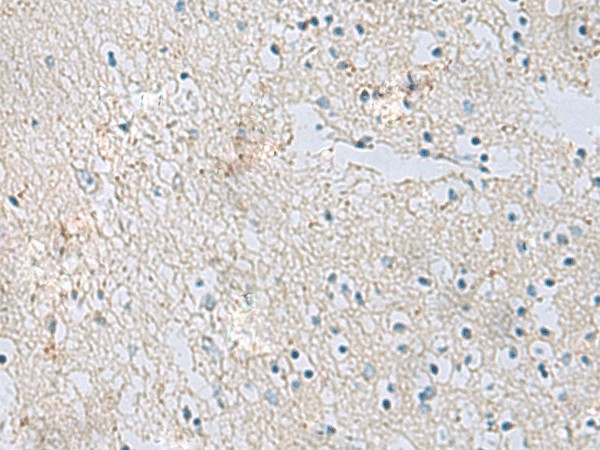 RDH5 Polyclonal Antibody (E-AB-53144)