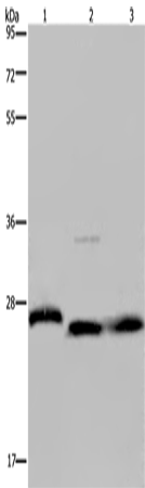 GSTP1 Polyclonal Antibody (E-AB-15088)