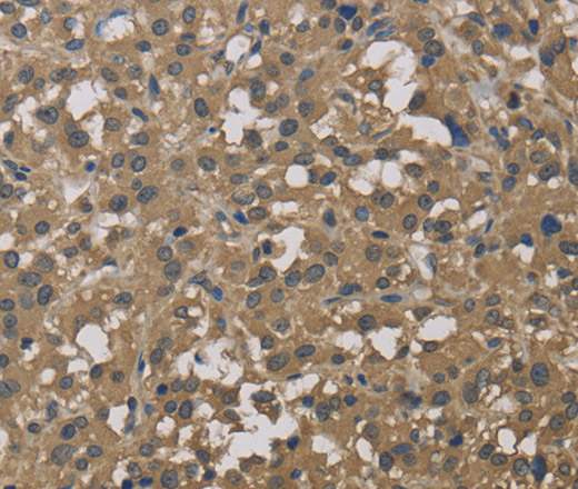 DCTN3 Polyclonal Antibody (E-AB-14937)