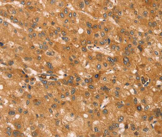 SNAP29 Polyclonal Antibody (E-AB-15400)