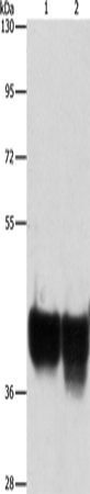 AUP1 Polyclonal Antibody (E-AB-10796)