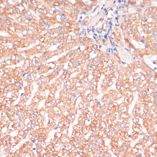 IKK alpha Polyclonal Antibody (E-AB-60585)