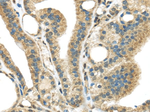 STK35 Polyclonal Antibody (E-AB-17441)