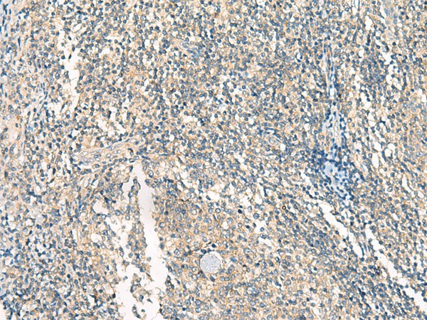 HASPIN Polyclonal Antibody (E-AB-18068)