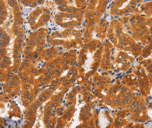 TNFRSF8 Polyclonal Antibody (E-AB-13119)