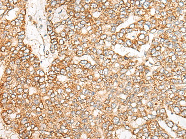 NME4 Polyclonal Antibody (E-AB-18243)