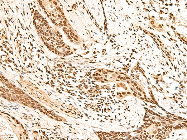 HOXC13 Polyclonal Antibody (E-AB-19998)
