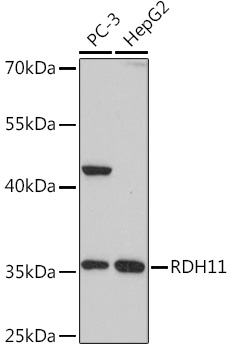 RDH11 Polyclonal Antibody (E-AB-92055)