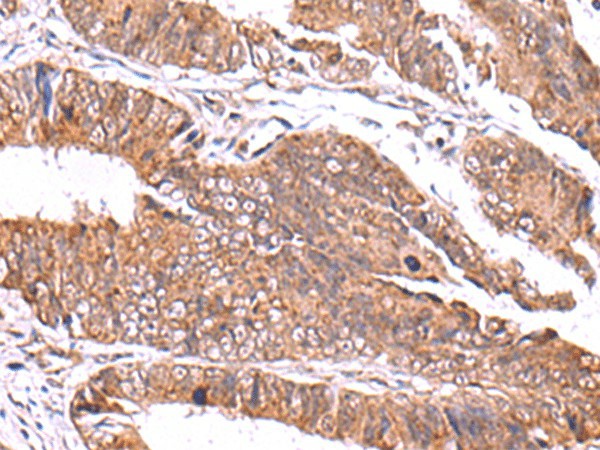GATM Polyclonal Antibody (E-AB-19032)