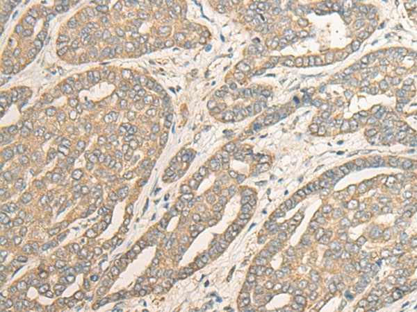 MYOZ2 Polyclonal Antibody (E-AB-18659)