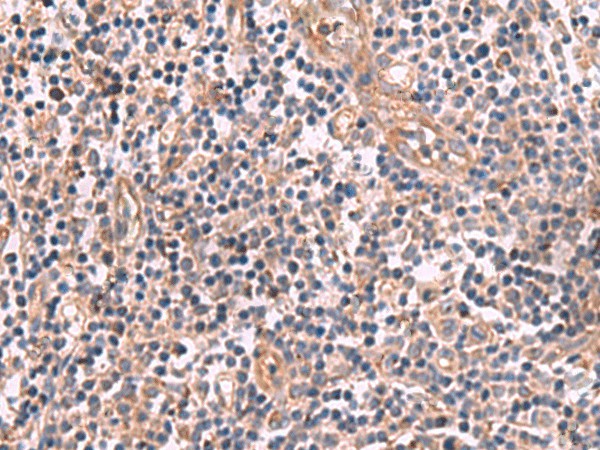 MGP Polyclonal Antibody (E-AB-18763)