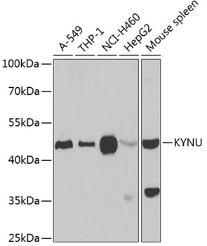 KYNU Polyclonal Antibody (E-AB-61268)
