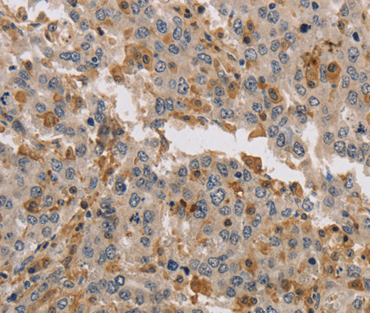 KIF17 Polyclonal Antibody (E-AB-13362)