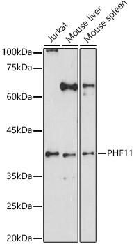 PHF11 Polyclonal Antibody (E-AB-92803)