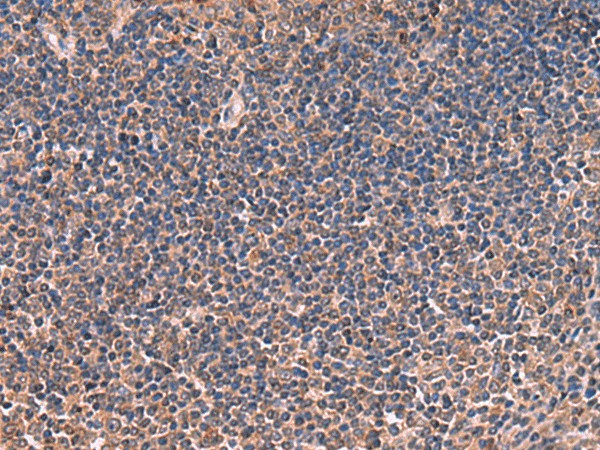 ITIH4 Polyclonal Antibody (E-AB-52050)