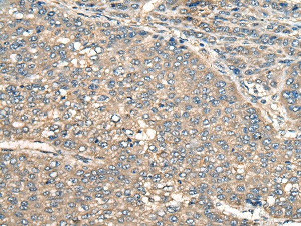 PIAS3 Polyclonal Antibody (E-AB-17823)