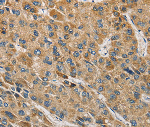 MIP Polyclonal Antibody (E-AB-10823)