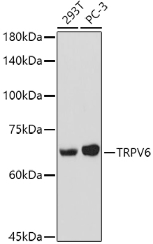 TRPV6 Polyclonal Antibody (E-AB-91436)