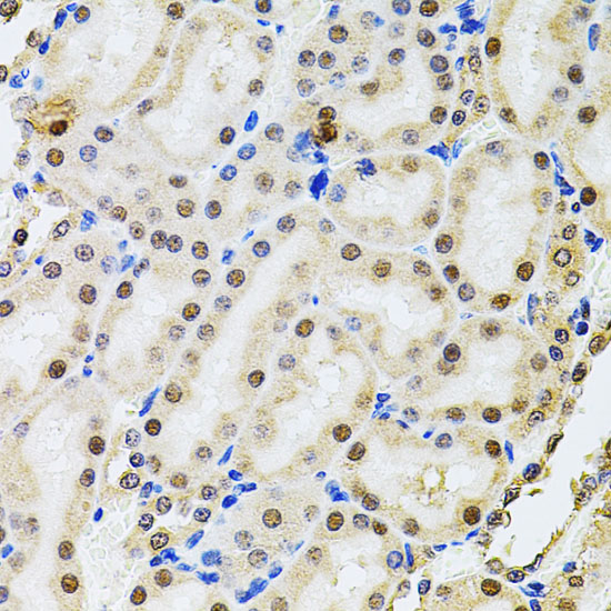 POP4 Polyclonal Antibody (E-AB-62363)