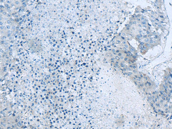 GLS Polyclonal Antibody (E-AB-53314)