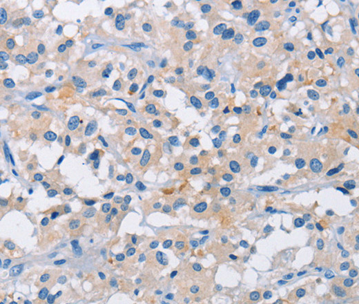 ATP6AP2 Polyclonal Antibody (E-AB-14778)