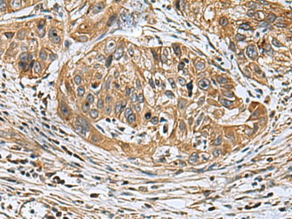 EARS2 Polyclonal Antibody (E-AB-18191)
