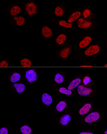 CPSF6 Polyclonal Antibody (E-AB-63831)