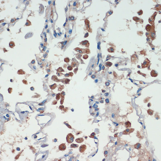 APC Polyclonal Antibody (E-AB-67493)