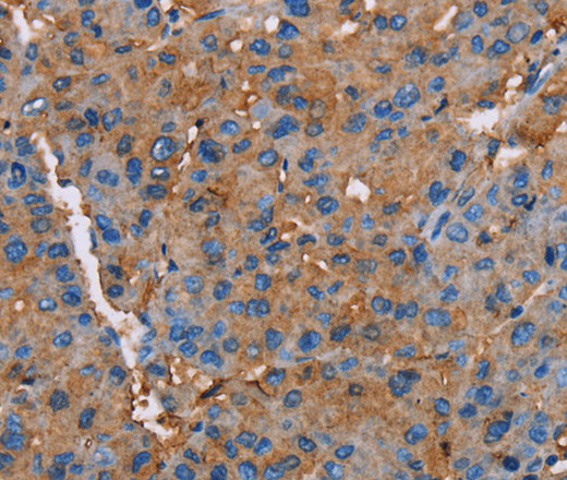 NLGN1 Polyclonal Antibody (E-AB-15253)