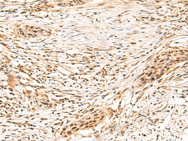 SETMAR Polyclonal Antibody (E-AB-52907)