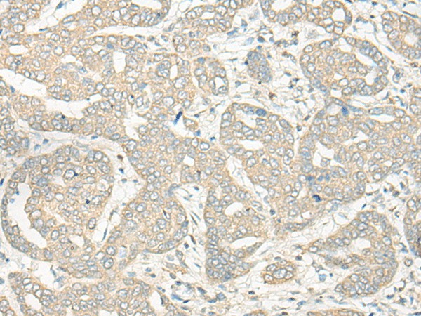 HLA-DRB5 Polyclonal Antibody (E-AB-18660)