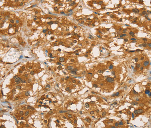 RBBP8 Polyclonal Antibody (E-AB-14899)