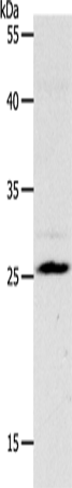 NQO2 Polyclonal Antibody (E-AB-12820)