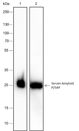 Recombinant Serum Amyloid P/SAP Monoclonal Antibody (AN301655L)
