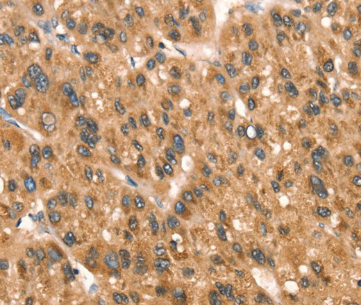 DAP Polyclonal Antibody (E-AB-16377)