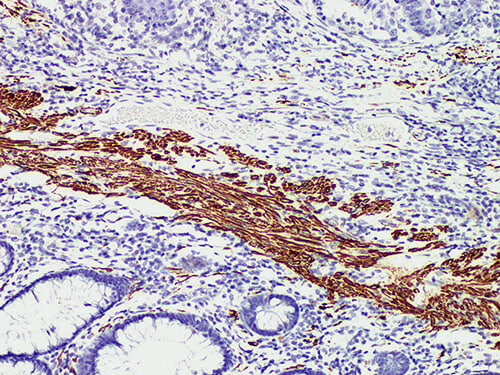 Desmin Monoclonal Antibody (ELAB6176-M)