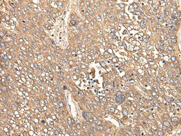 CALB1 Polyclonal Antibody (E-AB-17761)