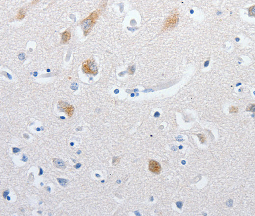 MATN1 Polyclonal Antibody (E-AB-15763)